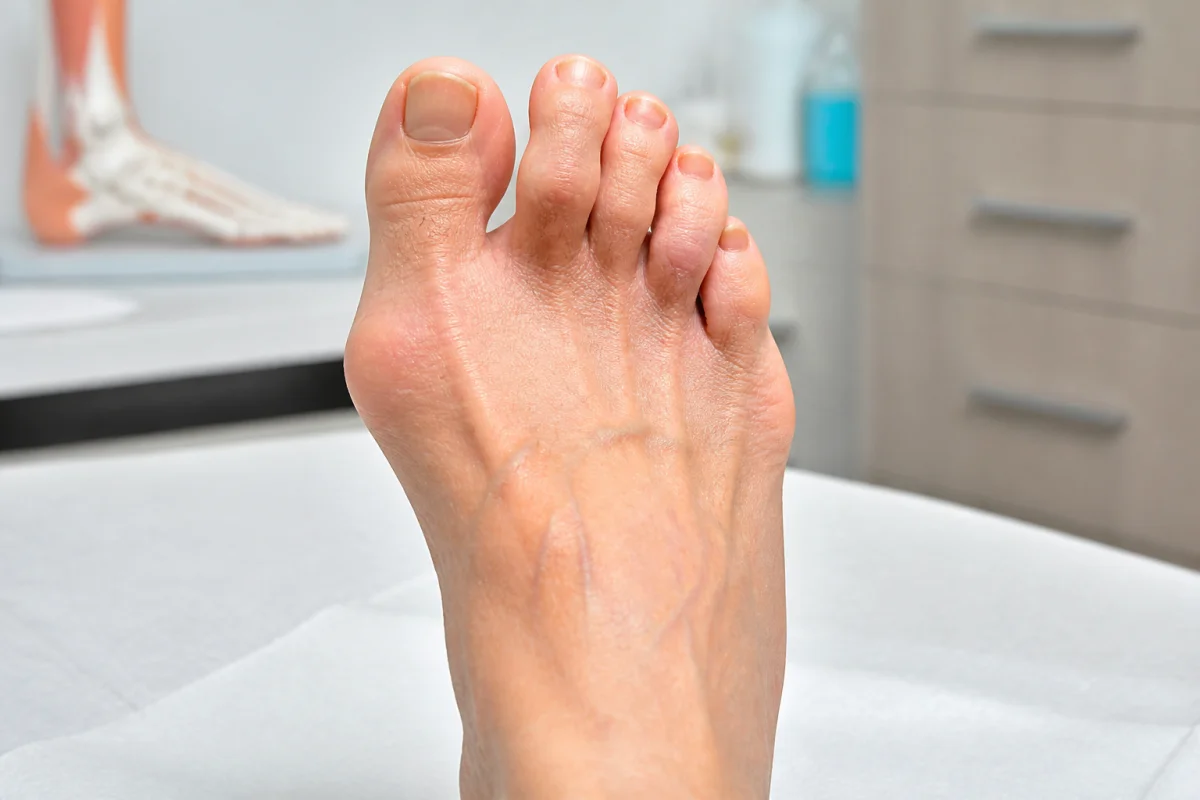 douleur pied polyarthrite